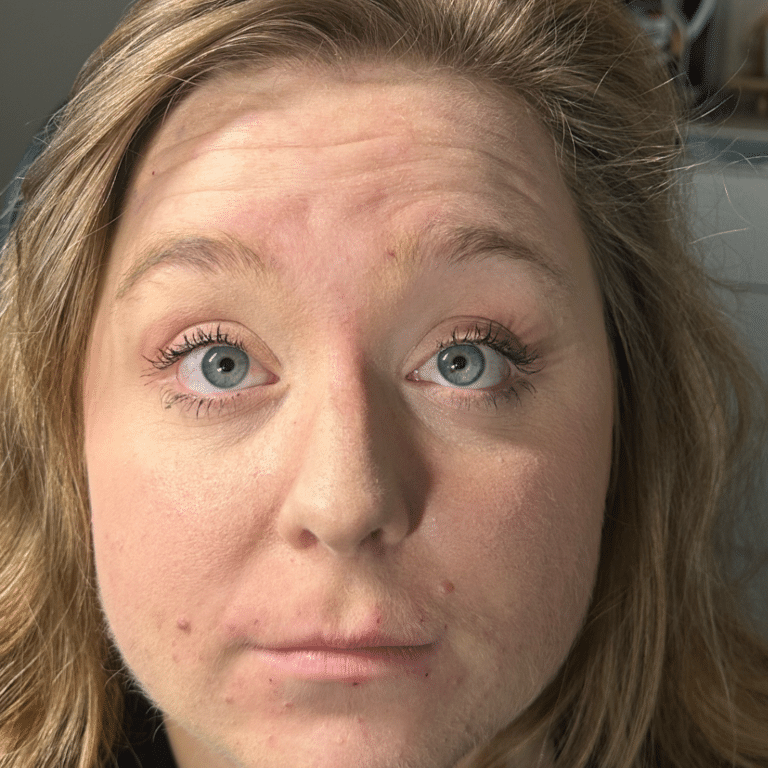 Before Image: Neurotoxin - front
