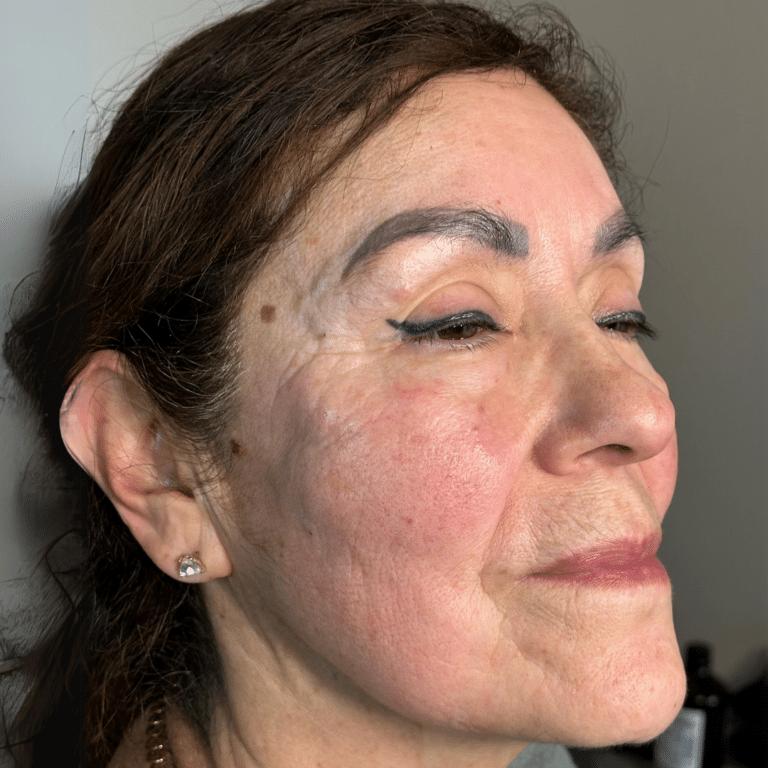 After Image: Biostimulator - right-front-oblique