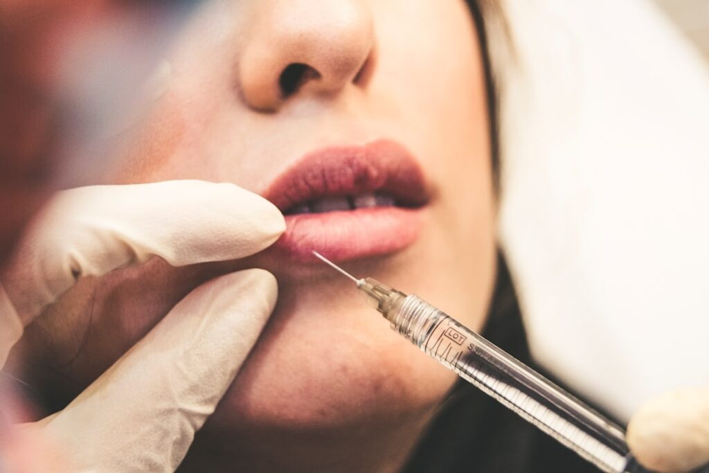 Latest Techniques in Lip Fillers in Albuquerque
